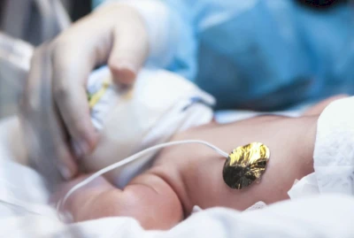 Technologické inovácie pre neonatologickú starostlivosť