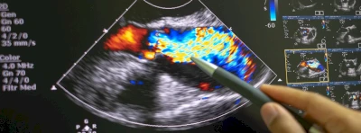 Ultrazvuková sonda Konted C10TX